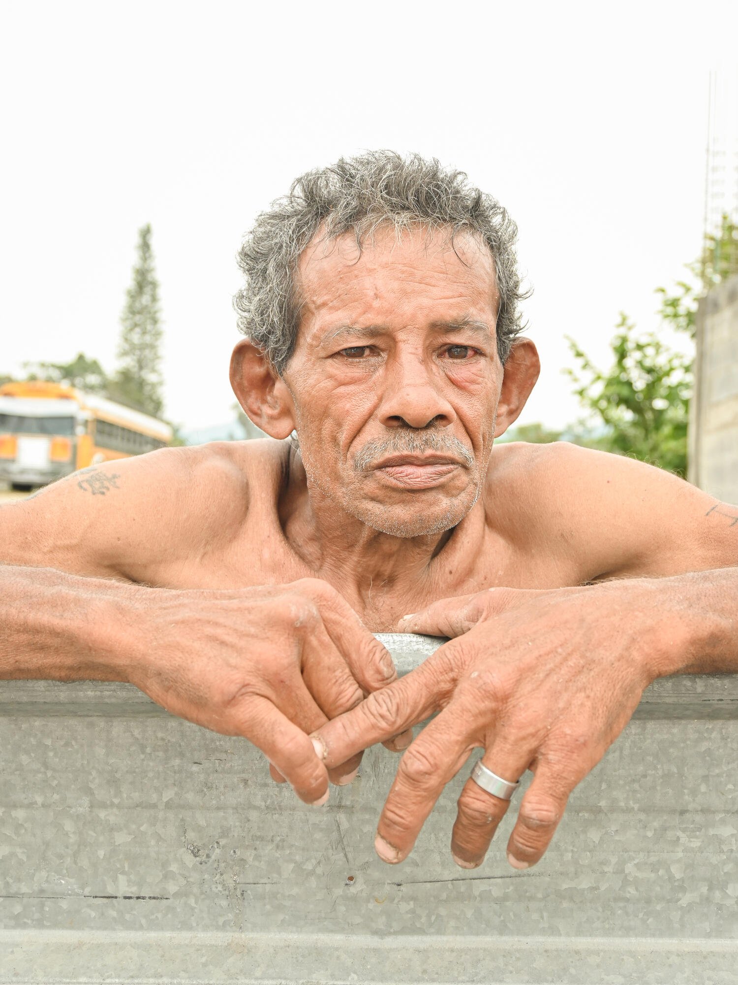 Rosendo Reyes (55) from Nicaragua. © Fernando Alvarado/MSF